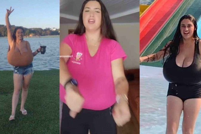 Os seios de Thaynara começaram a crescer anormalmente em fevereiro deste ano - (crédito: Instagram/Reprodução (@thay_marcondes01))