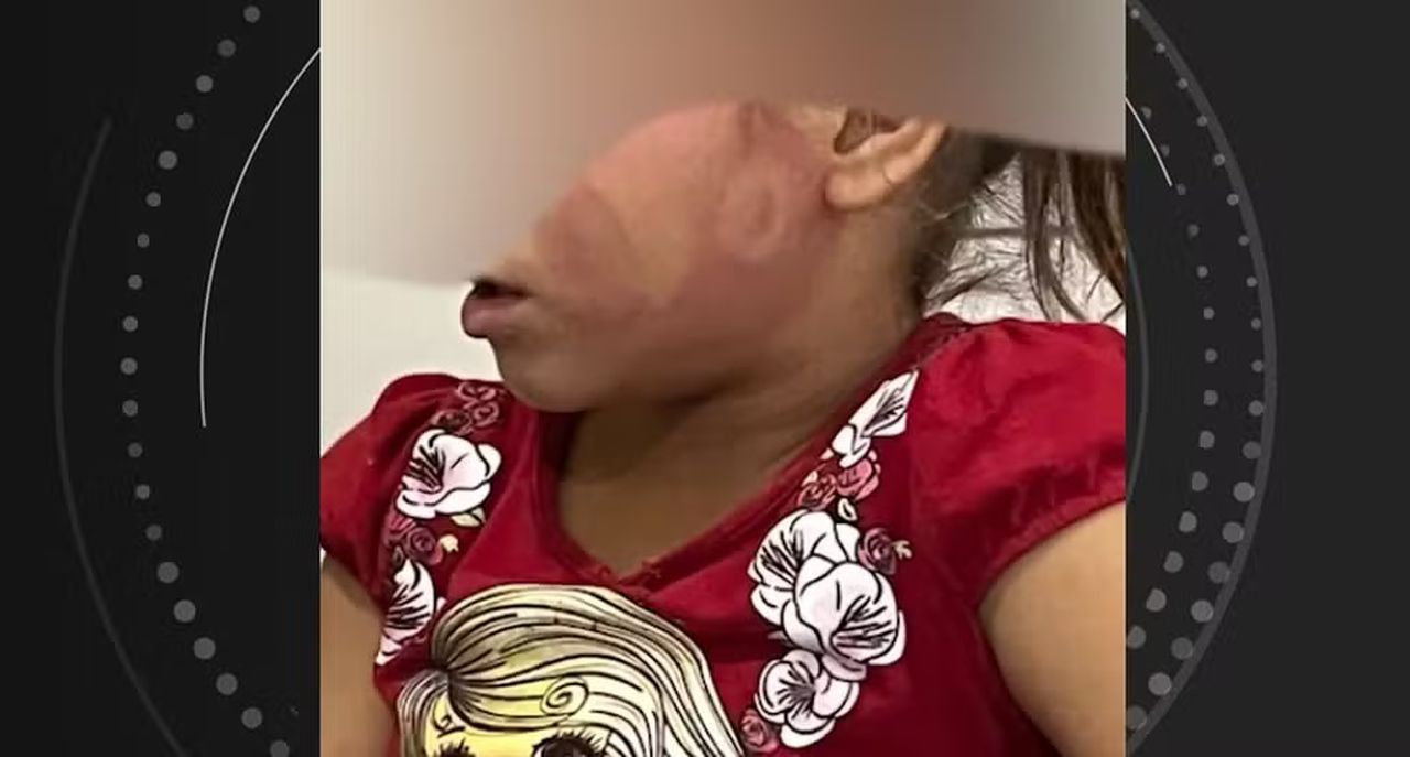 Pai bateu em filha com sandália no rosto em Taquarana, AL — Foto: Reprodução/TV Gazeta